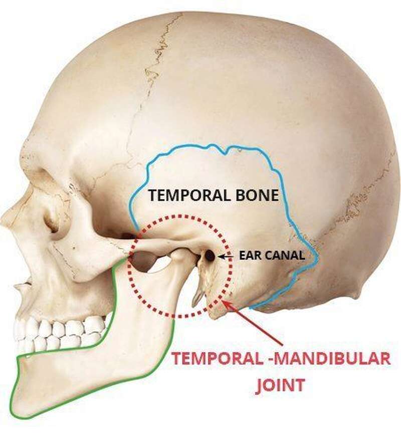 TMJ Disorders